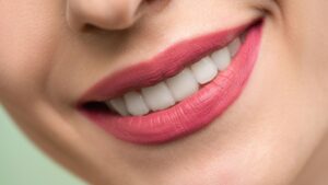 Fogfehérítés Budapest központjában a MyDent fogorvosi rendelőben